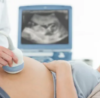 Exploring the Marvels of Obstetric Doppler: A Window into Fetal Well-Being