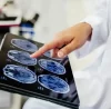 Revolutionizing Diagnostic Imaging