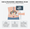 KUB ultrasound scan in Pune showing kidney and urinary bladder evaluation at Insight Imaging Clinic Thergaon