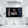 Color Doppler ultrasound scan showing blood flow in arteries and veins at Insight Imaging Clinic Pune