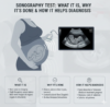 Sonography test in Pune showing ultrasound scan of abdominal organs at Insight Imaging Clinic Thergaon