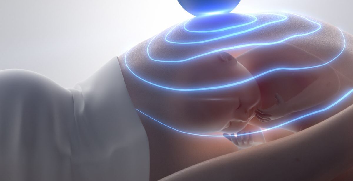 Pregnant woman undergoing obstetric ultrasound scan at a prenatal imaging clinic
