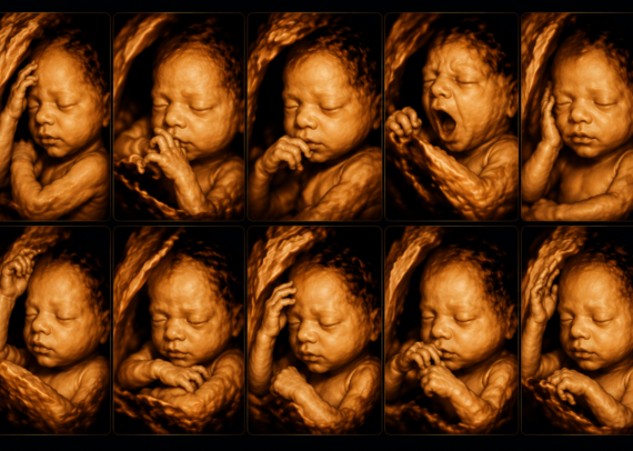 Pregnant woman in her third trimester undergoing a fetal growth scan with Doppler ultrasound while reviewing her baby's development. The image highlights the importance of serial growth monitoring, placental assessment, and fetal well-being evaluation during late pregnancy.